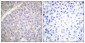 TH Polyclonal Antibody